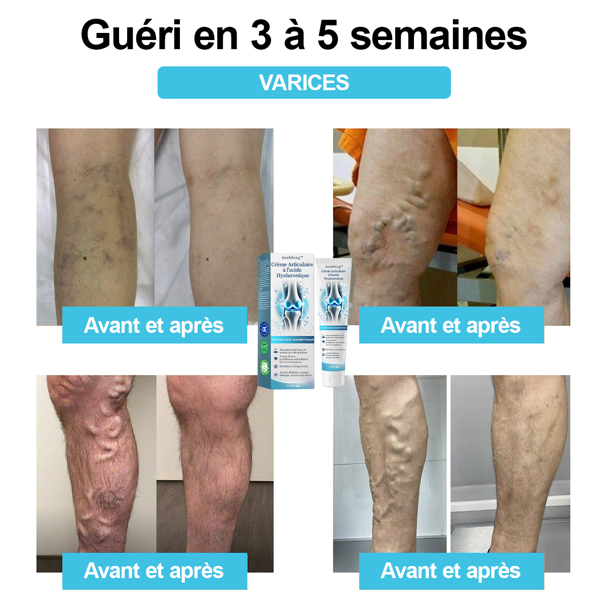 Il ne reste plus que 6 tubes ! Profitez de 30 % de réduction supplémentaire ! Les médecins orthopédistes recommandent d'utiliser 3-5 tubes pour un traitement complet, avec une guérison totale après utilisation !