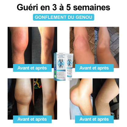 Il ne reste plus que 6 tubes ! Profitez de 30 % de réduction supplémentaire ! Les médecins orthopédistes recommandent d'utiliser 3-5 tubes pour un traitement complet, avec une guérison totale après utilisation !