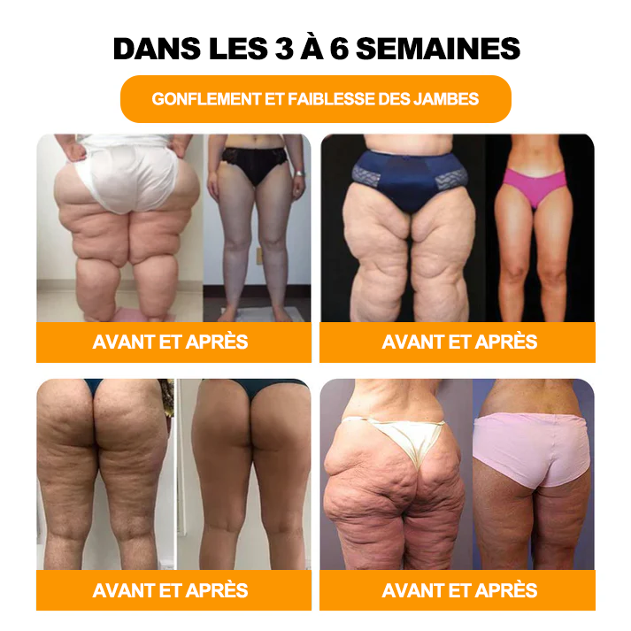 Aeehfeng™ 30 perles de bain détoxifiantes et amincissantes aux herbes💁‍♀️(recommandées par l'Association belge de lymphologie)👩‍⚕️