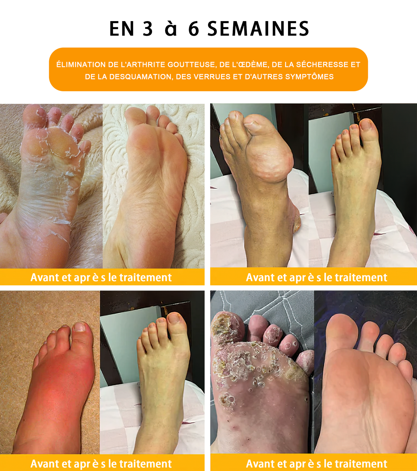 Aeehfeng™ 30 perles de bain détoxifiantes et amincissantes aux herbes💁‍♀️(recommandées par l'Association belge de lymphologie)👩‍⚕️