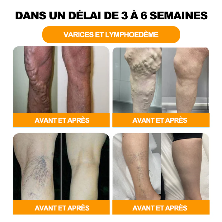 Aeehfeng™ 30 perles de bain détoxifiantes et amincissantes aux herbes💁‍♀️(recommandées par l'Association belge de lymphologie)👩‍⚕️